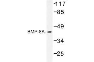 Image no. 1 for anti-Bone Morphogenetic Protein 8A (BMP8A) antibody (ABIN317821) (BMP8A Antikörper)