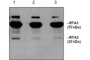 Western Blotting (WB) image for anti-Replication Protein A1, 70kDa (RPA1) antibody (ABIN190714) (RPA1 Antikörper)