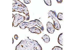 IHC analysis of RAB7/RAB7A using anti-RAB7/RAB7A antibody (ABIN7600597).