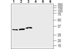 Western blot analysis of rat kidney (lanes 1 and 4), rat heart (lanes 2 and 5) and mouse kidney (lanes 3 and 6) membranes:1-3.