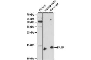 Western blot analysis of extracts of various cell lines, using RABIF antibody (ABIN7269786) at 1:1000 dilution. (RABIF Antikörper  (AA 1-123))