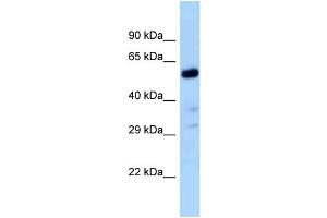 Host:  Rabbit  Target Name:  Zfp84  Sample Type:  Rat Liver lysates  Antibody Dilution:  1. (ZNF84 Antikörper  (C-Term))