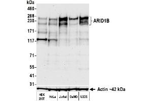 Western Blotting (WB) image for anti-AT Rich Interactive Domain 1B (SWI1-Like) (ARID1B) (AA 1425-1475) antibody (ABIN7795694) (Rekombinanter ARID1B Antikörper  (AA 1425-1475))