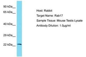 Image no. 1 for anti-RAB17, Member RAS Oncogene Family (RAB17) (AA 63-112) antibody (ABIN6750391) (RAB17 Antikörper  (AA 63-112))