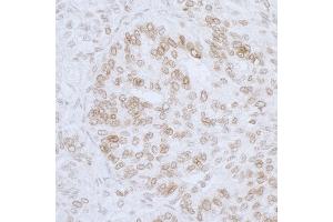 anti-LAP2 beta/tmpo (AA 300-350) antibody