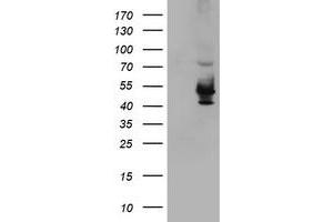 Western Blotting (WB) image for anti-Potassium Voltage-Gated Channel, Shaker-Related Subfamily, beta Member 1 (KCNAB1) antibody (ABIN1498999) (KCNAB1 Antikörper)