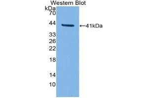 Detection of Recombinant TFR2, Human using Polyclonal Antibody to Transferrin Receptor 2 (TFR2) (Transferrin Receptor 2 Antikörper  (AA 604-703))