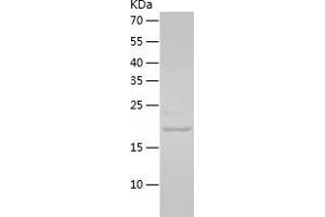 Western Blotting (WB) image for Ciliary Neurotrophic Factor (CNTF) (AA 1-200) protein (His tag) (ABIN7122401) (CNTF Protein (AA 1-200) (His tag))