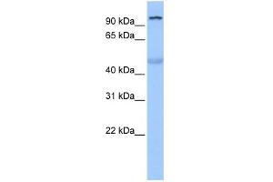 WB Suggested Anti-TULP3 Antibody Titration:  0. (TULP3 Antikörper  (N-Term))