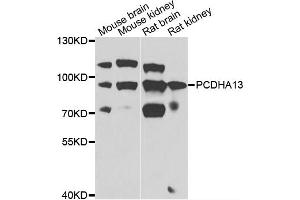 Western blot analysis of extracts of various cell lines, using PCDHA13 antibody (ABIN4904701) at 1:1000 dilution. (PCDHa13 Antikörper)