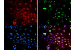 Immunofluorescence analysis of GFP-RNF168 transgenic U2OS cell using L3MBTL1 antibody. (L3MBTL1 Antikörper)