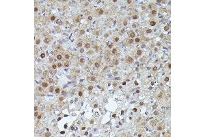 Immunohistochemistry of paraffin-embedded human esophagus using S100 Rabbit pAb (ABIN3015803, ABIN3015804, ABIN3015805, ABIN1682607 and ABIN6219148) at dilution of 1:100 (40x lens). (S100A10 Antikörper  (AA 1-97))