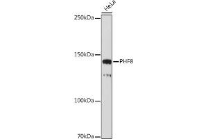 Western blot analysis of extracts of HeLa cells, using PHF8 antibody (ABIN7269263) at 1:1000 dilution. (PHF8 Antikörper)