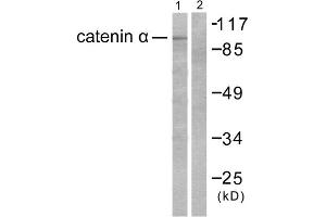 Western blot analysis of extracts from HeLa cells, using Catenin- alpha antibody. (CTNNA1 Antikörper  (C-Term))