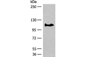 Western blot analysis of PC-3 cell lysate using GARNL3 Polyclonal Antibody at dilution of 1:400 (GARNL3 Antikörper)