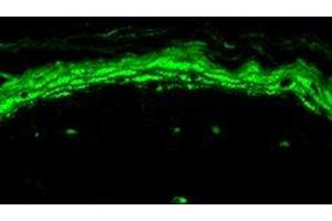 Immunohistochemistry analysis using Mouse Anti-Nav1. (Nav1.8 Antikörper  (AA 1724-1956) (PerCP))