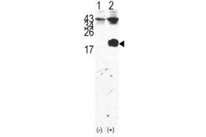 Western blot analysis of FKBP12 antibody and 293 cell lysate either nontransfected (Lane 1) or transiently transfected with the FKBP12 gene (2). (FKBP1A Antikörper  (AA 43-74))