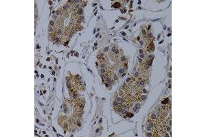 Immunohistochemistry of paraffin-embedded human normal stomach using TNFRSF6B antibody at dilution of 1:200 (400x lens). (TNFRSF6B Antikörper)