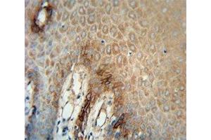 Immunohistochemistry (IHC) image for anti-Integrin, alpha 6 (ITGA6) antibody (ABIN3029807)