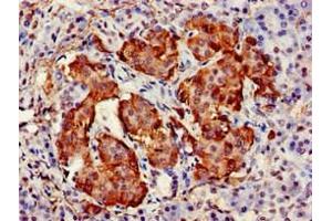 Immunohistochemistry of paraffin-embedded human pancreatic tissue using ABIN7171509 at dilution of 1:100
