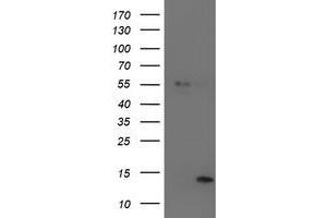 Western Blotting (WB) image for anti-Leukocyte Cell-Derived Chemotaxin 2 (LECT2) (AA 19-151) antibody (ABIN1491076)