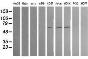 Western Blotting (WB) image for anti-Aldehyde Dehydrogenase 1 Family, Member A3 (ALDH1A3) (AA 1-100), (AA 413-512) antibody (ABIN2715885)