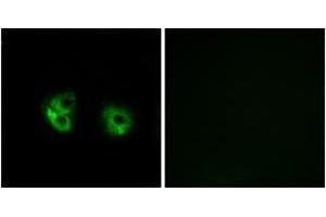 Immunofluorescence analysis of A549 cells, using MARCH2 Antibody.