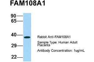 Host: Rabbit  Target Name: FAM108A1  Sample Tissue: Human Adult Placenta  Antibody Dilution: 1. (ABHD17A Antikörper  (C-Term))