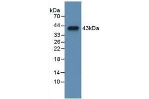 Detection of Recombinant CCK, Mouse using Polyclonal Antibody to Cholecystokinin (CCK) (Cholecystokinin Antikörper  (AA 1-115))