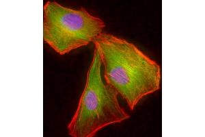 Immunofluorescent analysis of 4 % paraformaldehyde-fixed, 0. (TUBB2A Antikörper  (AA 194-225))