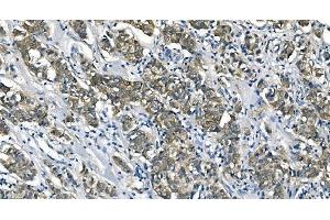 IHC analysis of ASS1 using anti-ASS1 antibody (ABIN7601192). (ASS1 Antikörper  (AA 3-365))