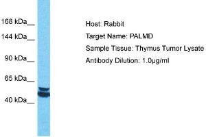 Host: Rabbit Target Name: PALMD Sample Tissue: Human Thymus Tumor Antibody Dilution: 1ug/ml