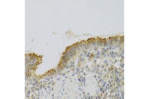 Immunohistochemistry of paraffin-embedded rat lung using PA2G4 Antibody (ABIN1876564) at dilution of 1:100 (40x lens). (PA2G4 Antikörper)