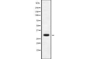 Western blot analysis of MRPS15 using Jurkat whole cell lysates (MRPS15 Antikörper  (Internal Region))