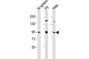 All lanes : Anti-SUZ12 Antibody (Center) at 1:2000 dilution Lane 1: mouse spleen lysates Lane 2: F9 whole cell lysates Lane 3: Hela whole cell lysates Lysates/proteins at 20 μg per lane. (SUZ12 Antikörper  (AA 375-408))