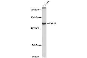 Western blot analysis of extracts of Rat liver, using ER Rabbit mAb (ABIN7266941) at 1:1000 dilution. (ERAP1 Antikörper)