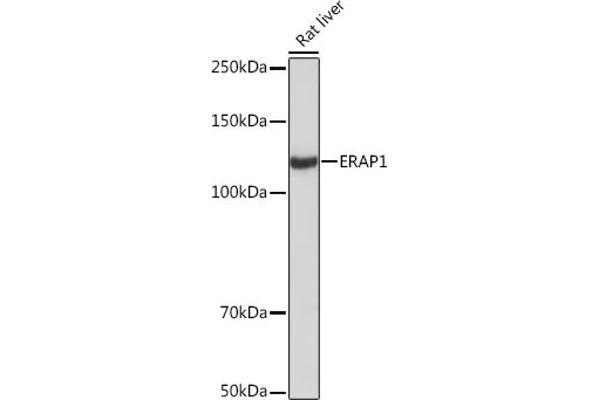 ERAP1 Antikörper