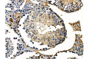 Phospho-DYR1A (Tyr449) Antibody at 1/100 staining Mouse testis tissue by IHC-P.