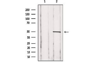 Western blot analysis of extracts from Mouse spleen, using GDI2 Antibody. (GDI2 Antikörper  (Internal Region))