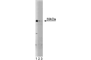 Western blot analysis of Akt on HCT-8 cell lysate (Human colorectal adenocarcinoma, ATCC CCL-244).