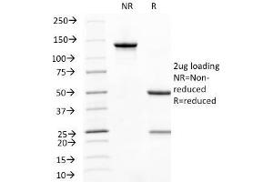 SDS-PAGE Analysis Purified CD31 Mouse Monoclonal Antibody (C31. (CD31 Antikörper)