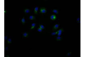 Immunofluorescence staining of MCF7 Cells with ABIN7127404 at 1:50, counter-stained with DAPI. (Rekombinanter CD47 Antikörper)