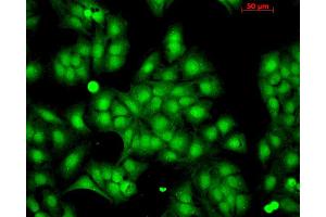 Immunocytochemistry/Immunofluorescence analysis using Rabbit Anti-HSP22 Polyclonal Antibody .