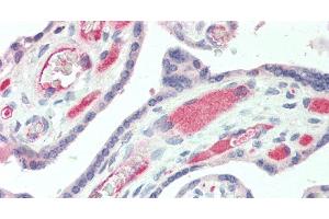 Immunohistochemistry of paraffin-embedded Human Placenta using IBSP Polyclonal Antibody at dilution of 1:50. (IBSP Antikörper)