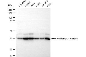 Western blotting analysis using MacroH2A.