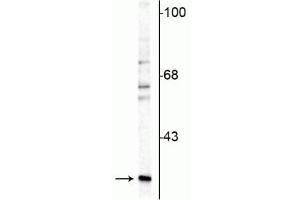 Western blot of rat cerebellar lysate showing specific immunolabeling of the ~29 kDa calretinin protein. (Calretinin Antikörper)