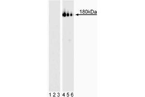 Western blot analysis of PDGFRbeta (pY857). (PDGFRB Antikörper  (pTyr857))