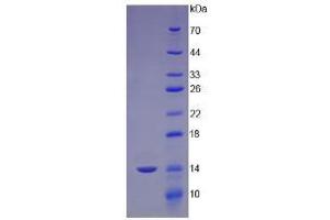 SDS-PAGE analysis of Human Cubilin Protein. (CUBN Protein)