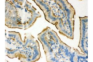 Immunohistochemistry (IHC) image for anti-Plectin (PLEC) (AA 2644-2671), (Middle Region) antibody (ABIN3043900)