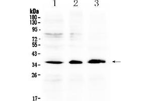 Western blot analysis of AKR1B10 using anti- AKR1B10 antibody . (AKR1B10 Antikörper  (C-Term))